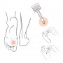 Solution anti-verrues pieds et mains | Inula